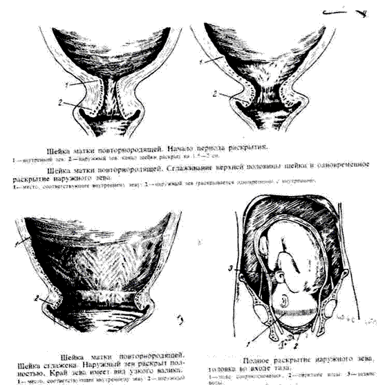 Как выглядит шейка матки при беременности на ранних сроках на фото ощупь и перед месячными