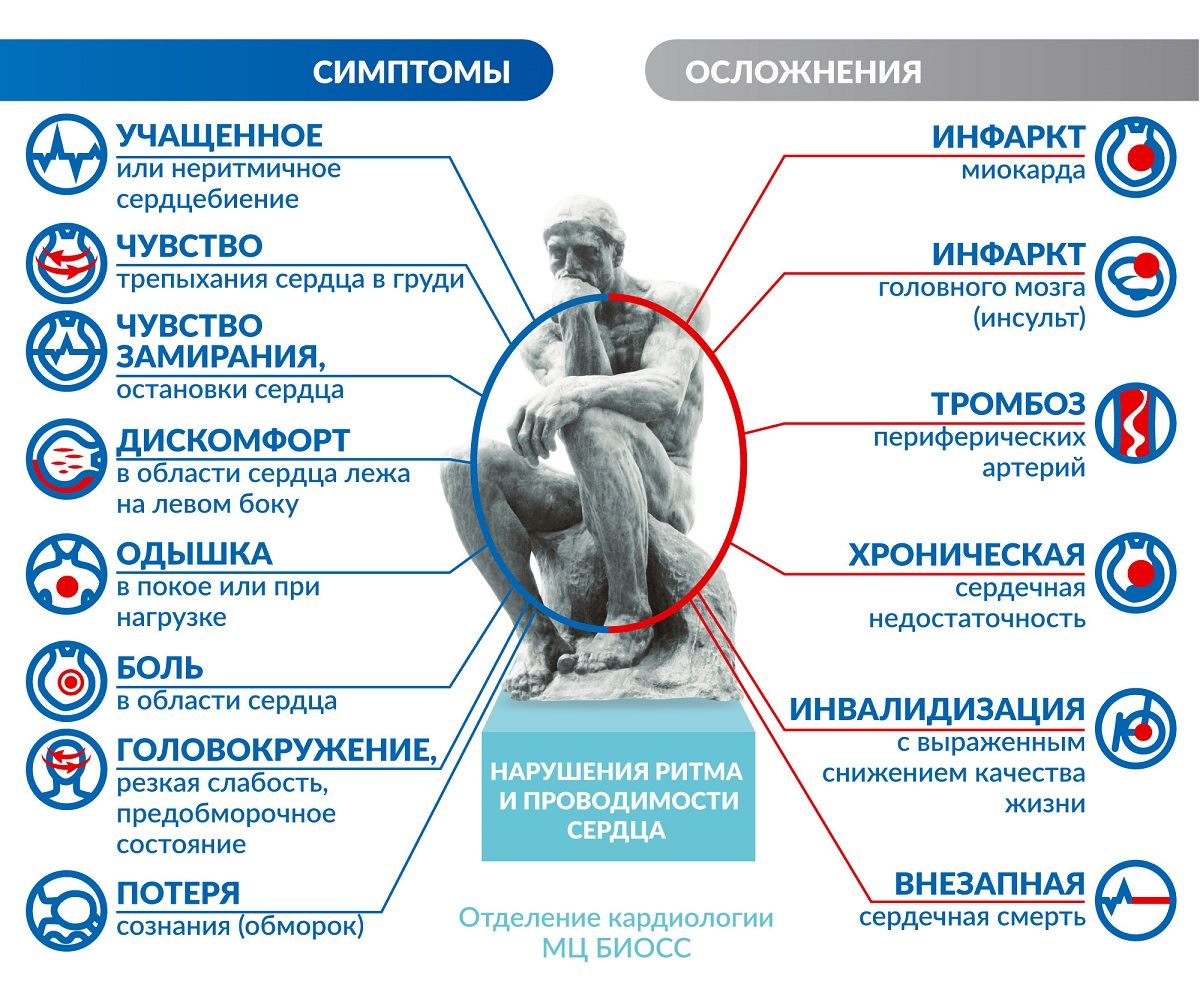 Замирание сердца причины и симптомы лечение у женщин препараты схема лечения