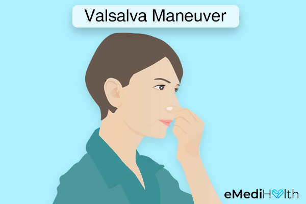 Valsalva maneuver for unclogging your blocked ears