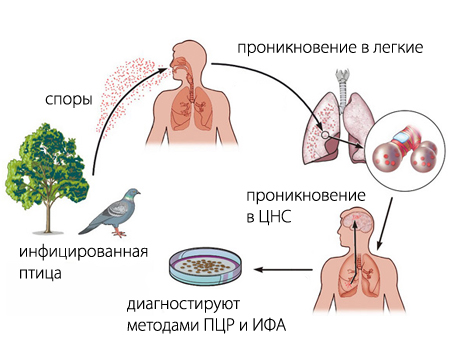 орнитоз