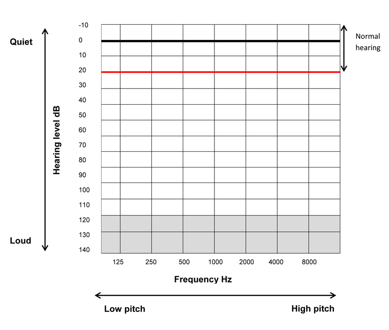 A diagram of a blank audiogram, with sound pitch (frequency) along the horizontal axis and sound loudness along the vertical axis
