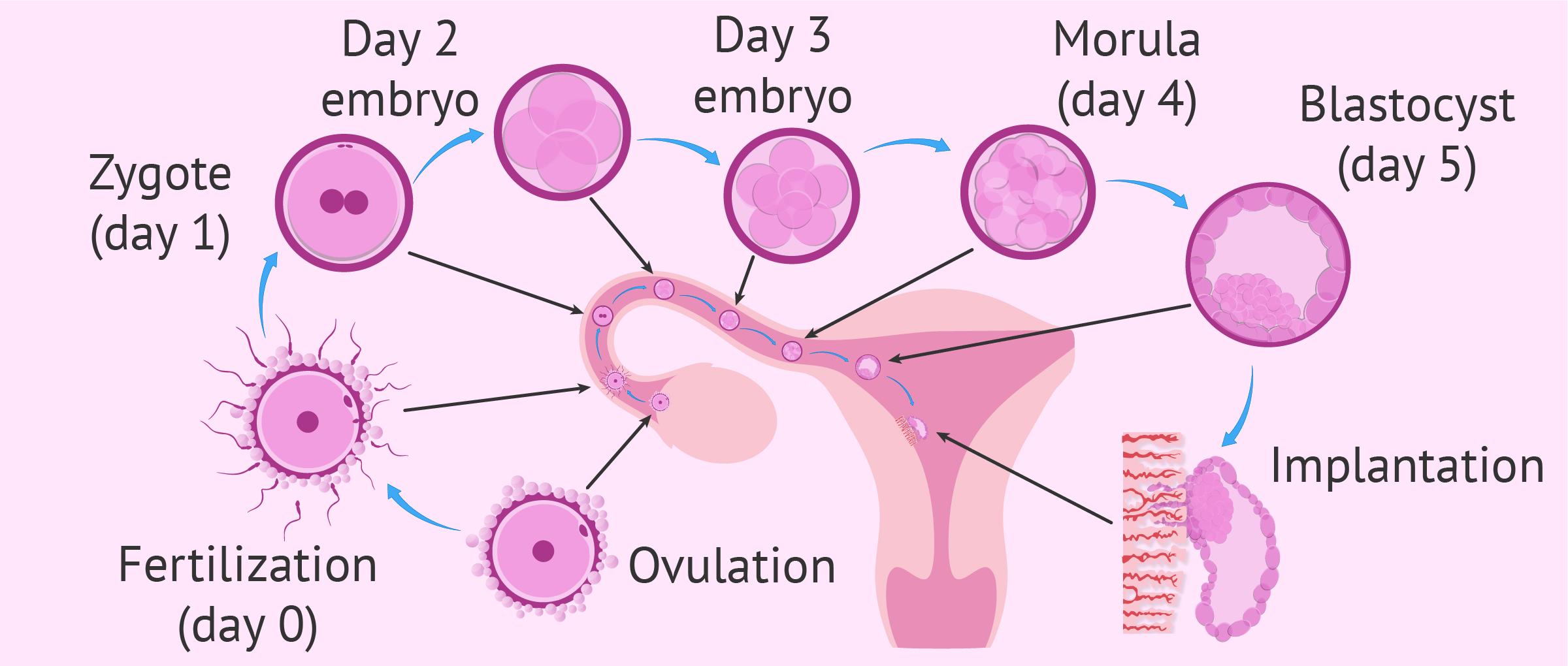 Transferencia embrionaria cuando se implanta