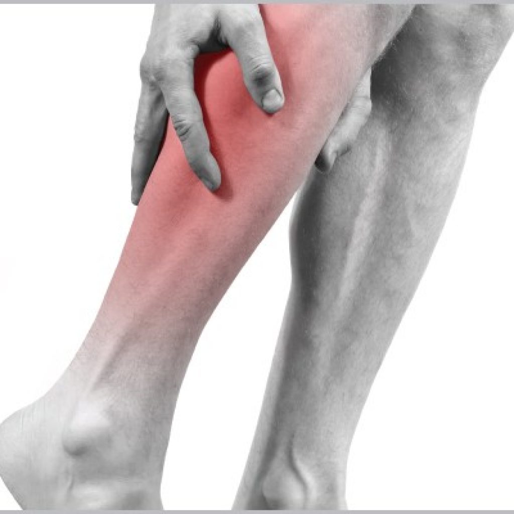 Болят ноги колени к какому врачу обратиться. Облитерирующий тромбофлебит. Облитерирующий атеросклероз вен нижних конечностей. Облитерирующий атеросклероз сосудов конечностей. Облитерирующий атеросклероз артерий ног.
