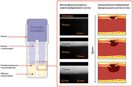 Метод Тромбодинамики: схематическое изображение кюветы и типичные фотографии роста сгустка