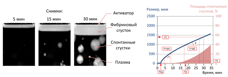 Связь параметров тромбодинамики с состоянием системы гемостаза