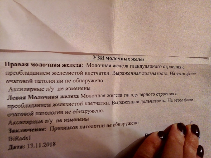 Узи молочный на какой день. Норма УЗИ молочной железы заключение. Молочная железа протокол УЗИ норма. УЗИ молочных желез заключение в норме. УЗИ молочной железы протоколы норма.