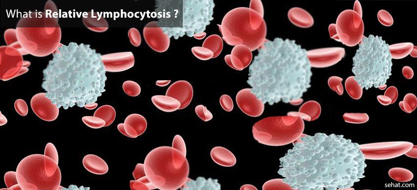 Relative lymphocytosis causes,symptoms,treatment