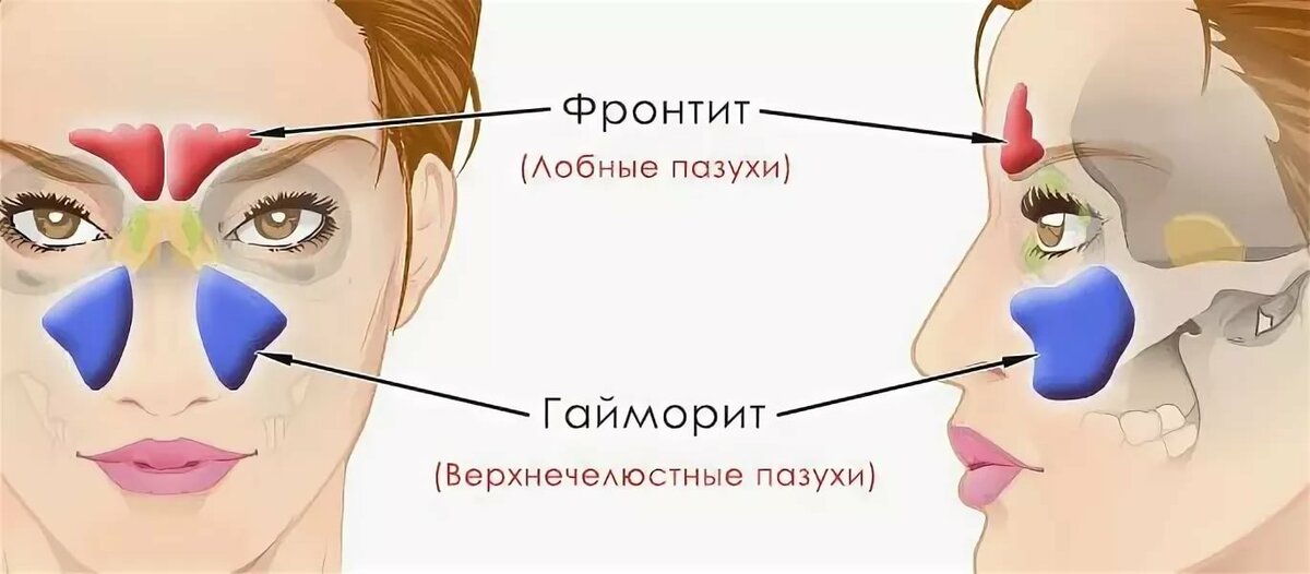 Гайморовы пазухи расположение схема рисунок