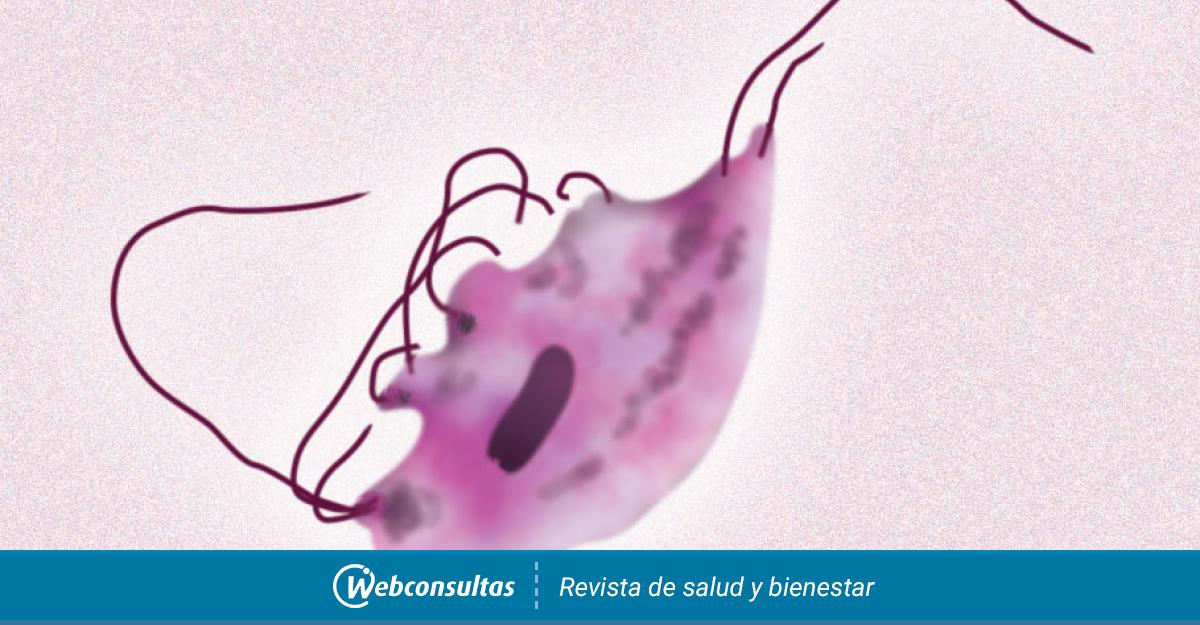 Ротовая трихомонада. Влагалищная трихомонада. Trichomonas Hominis возбудитель. Trichomonas vaginalis заболевание.